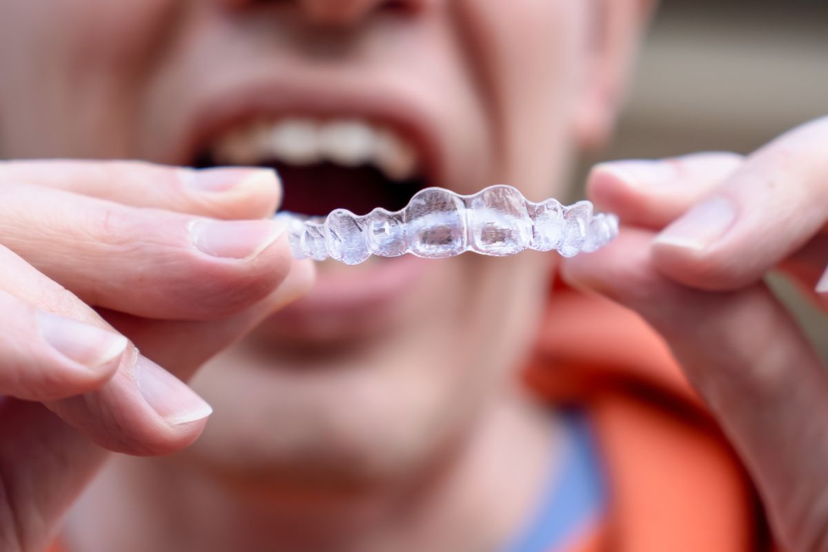 Person holding clear Invisalign aligners, highlighting proper care for effective teeth straightening treatment.
