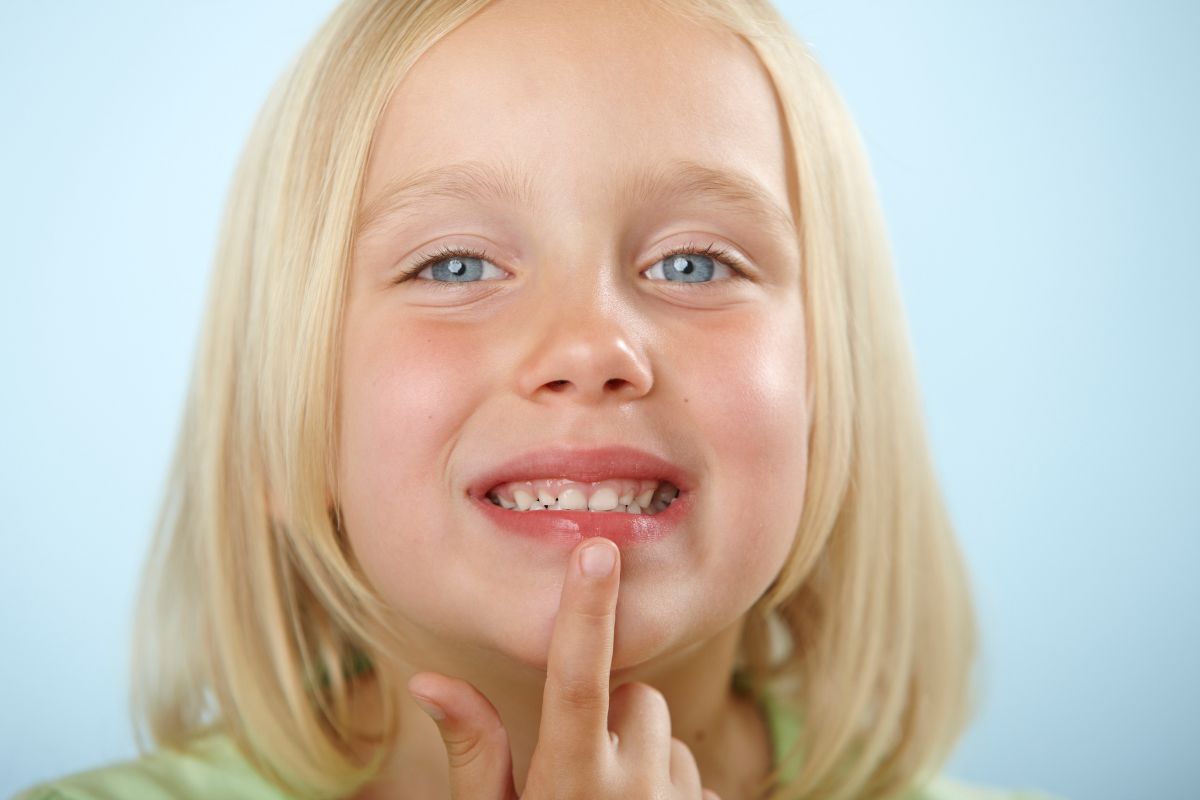 Child pointing to teeth, highlighting early signs of enamel damage from sugary drinks.